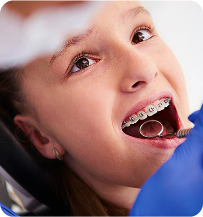 braces