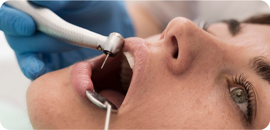 Cosmotic-Fillings