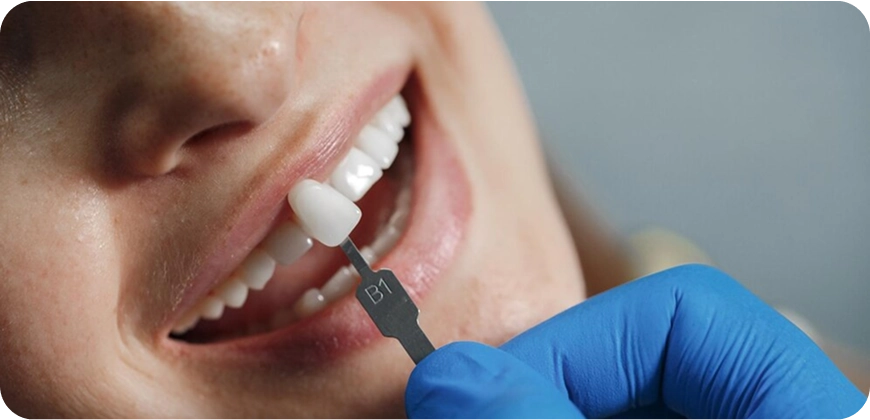 DentalImplants