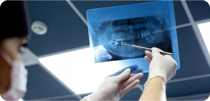 DentalXrays