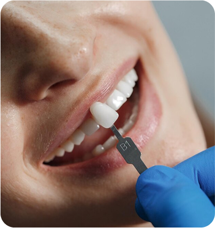 Cosmetic Fillings