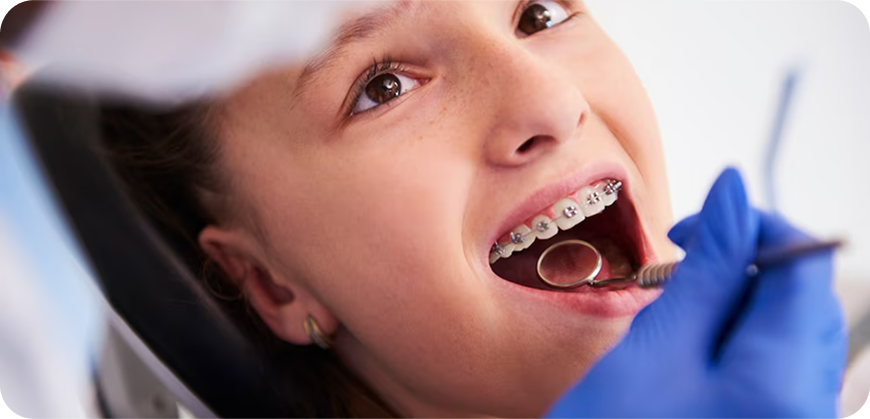 Orthodontic Treatment